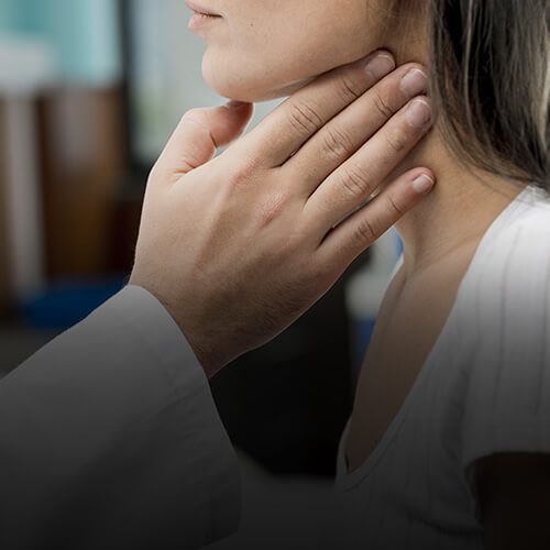 Tratamento Tireoide