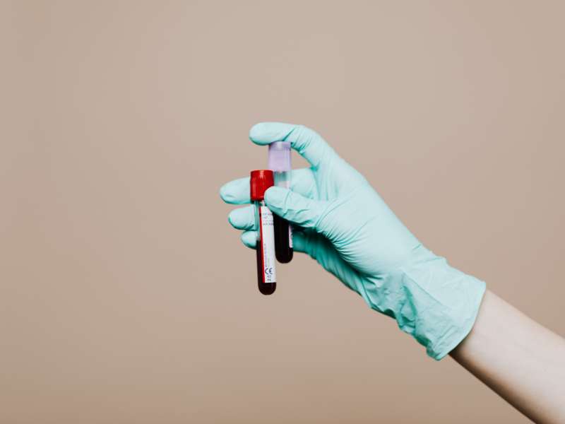 profissional de laboratório segurando um tubo de ensaio com uma amostra de sangue
