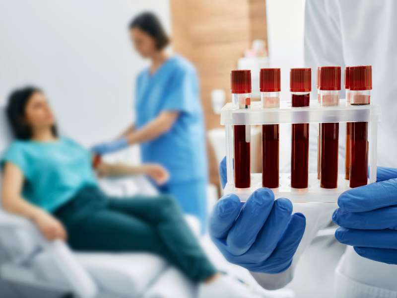 exames de sangue e análises hormonais